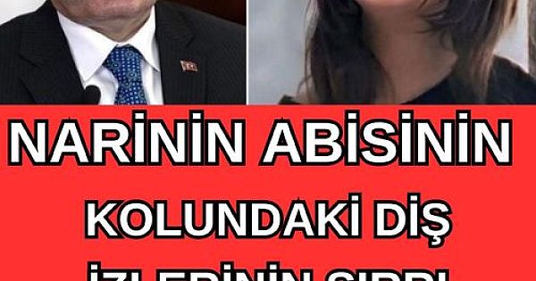 Diş izlerinin sırrı çözüldü!