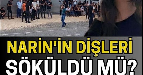 Narin'in Dişleri Sökülmüş Olabilir