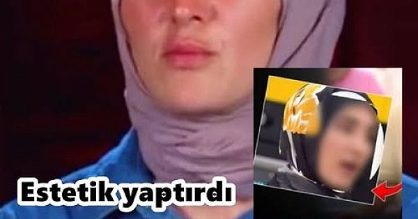 Estetik yaptıran MasterChef Ayşe Ekiz'in değişimi ağızları açık bıraktı